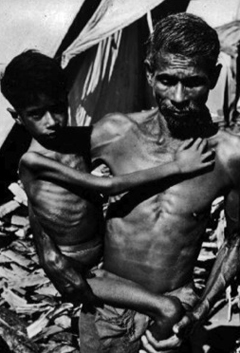 Child suffering with Marasmus (extreme emaciation) in India: Photograph courtesy of the CDC